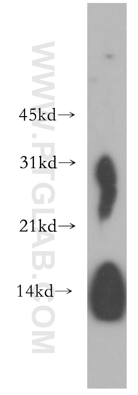 WB analysis of mouse lung using 15013-1-AP