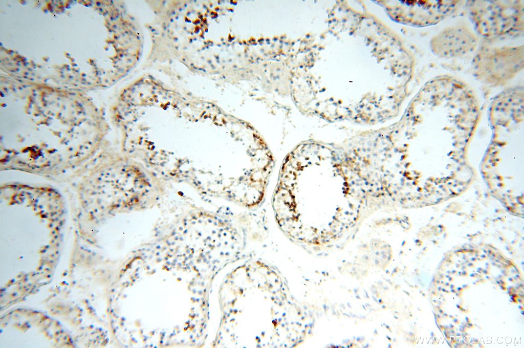 IHC staining of human testis using 17207-1-AP