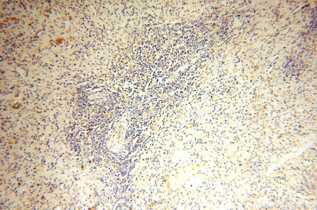 Immunohistochemistry (IHC) staining of human spleen tissue using LYZL1 Polyclonal antibody (17207-1-AP)