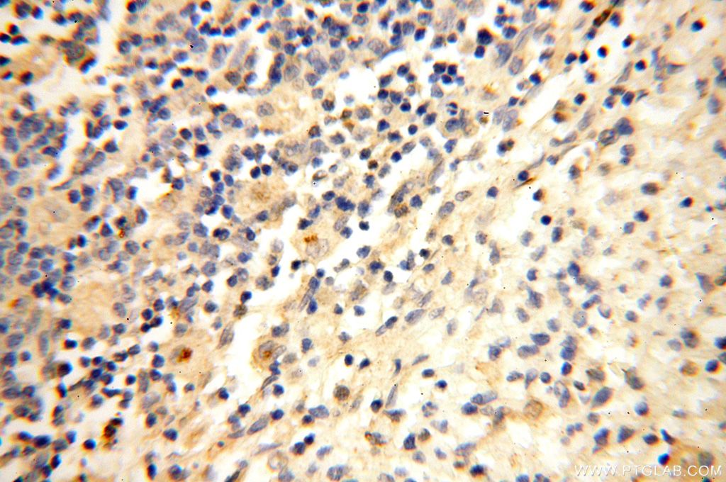 Immunohistochemistry (IHC) staining of human spleen tissue using LYZL1 Polyclonal antibody (17207-1-AP)