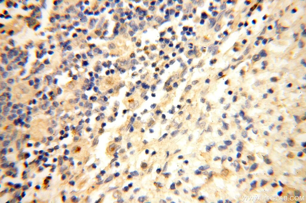 IHC staining of human spleen using 17207-1-AP