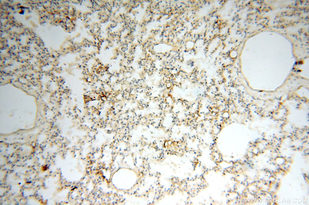 Immunohistochemistry (IHC) staining of human lung tissue using LYZL1 Polyclonal antibody (17207-1-AP)