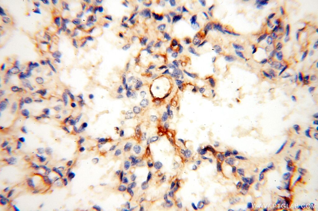 Immunohistochemistry (IHC) staining of human lung tissue using LYZL1 Polyclonal antibody (17207-1-AP)