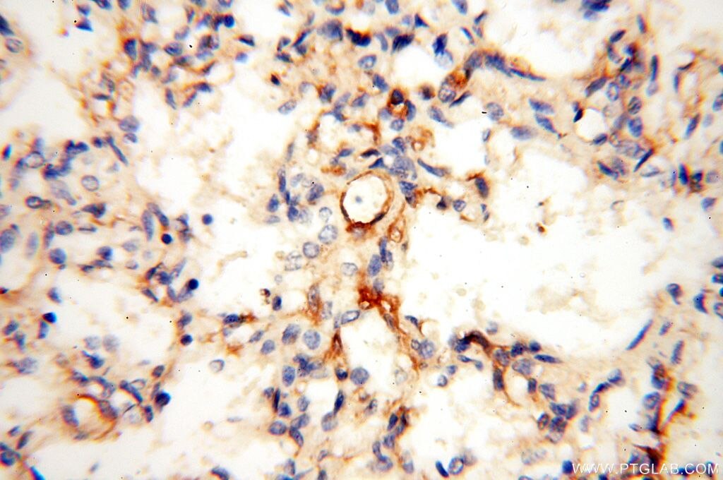 Immunohistochemistry (IHC) staining of human lung tissue using LYZL1 Polyclonal antibody (17207-1-AP)