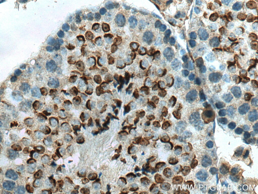 IHC staining of mouse testis using 11922-1-AP