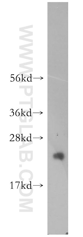 Western Blot (WB) analysis of HepG2 cells using LZIC Polyclonal antibody (14543-1-AP)