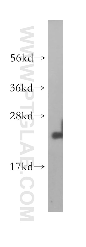 Western Blot (WB) analysis of HEK-293 cells using LZIC Polyclonal antibody (14543-1-AP)