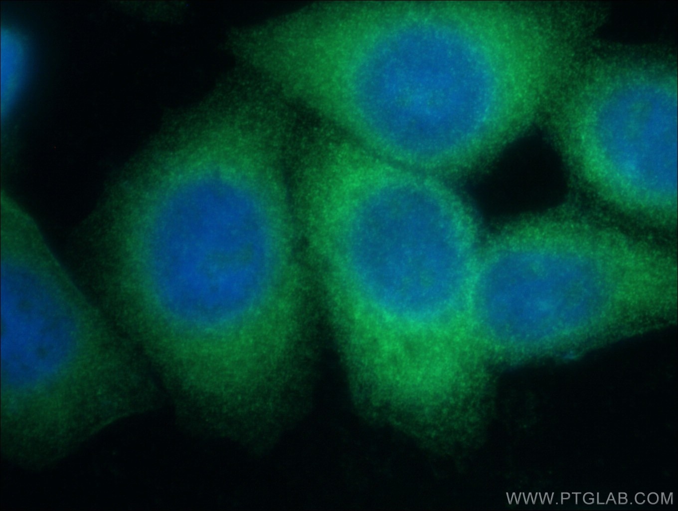 Immunofluorescence (IF) / fluorescent staining of HepG2 cells using LZTFL1 Polyclonal antibody (17073-1-AP)