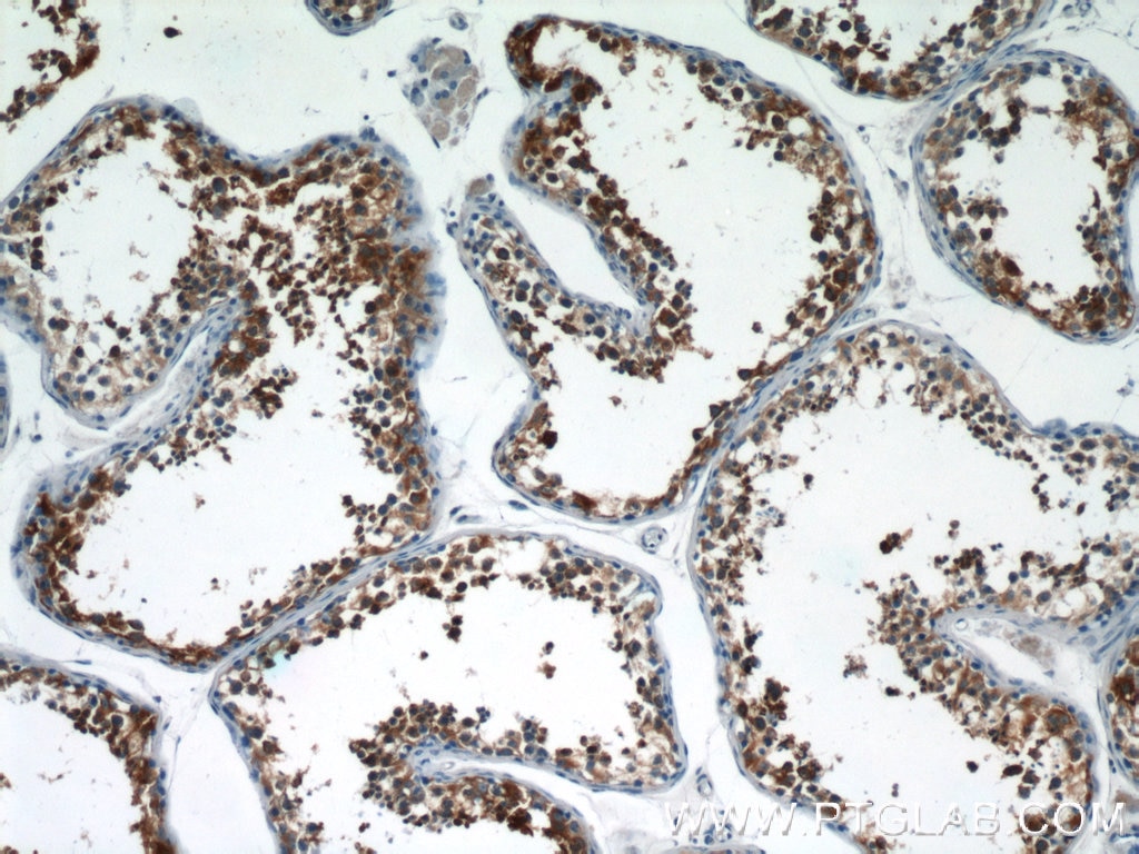 Immunohistochemistry (IHC) staining of human testis tissue using LZTFL1 Polyclonal antibody (17073-1-AP)