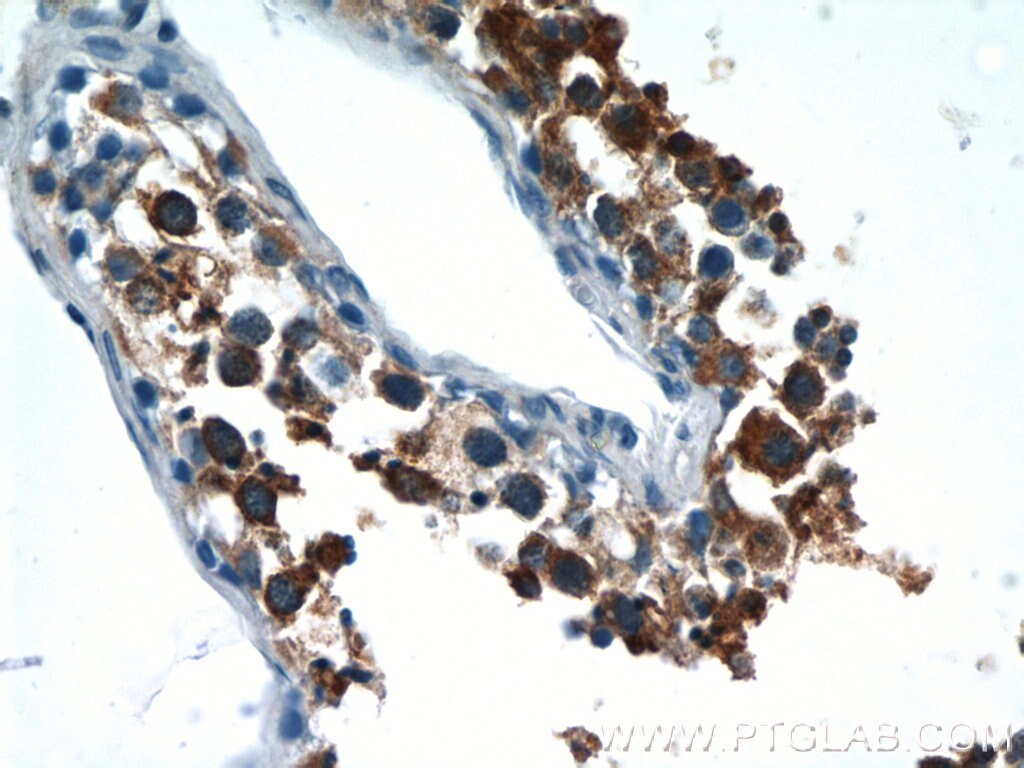 Immunohistochemistry (IHC) staining of human testis tissue using LZTFL1 Polyclonal antibody (17073-1-AP)