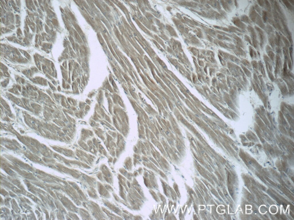 Immunohistochemistry (IHC) staining of human heart tissue using LZTFL1 Polyclonal antibody (17073-1-AP)