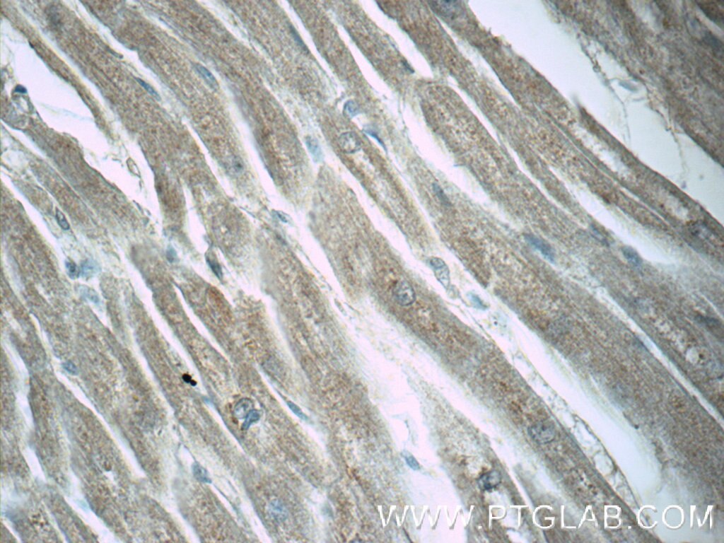 Immunohistochemistry (IHC) staining of human heart tissue using LZTFL1 Polyclonal antibody (17073-1-AP)