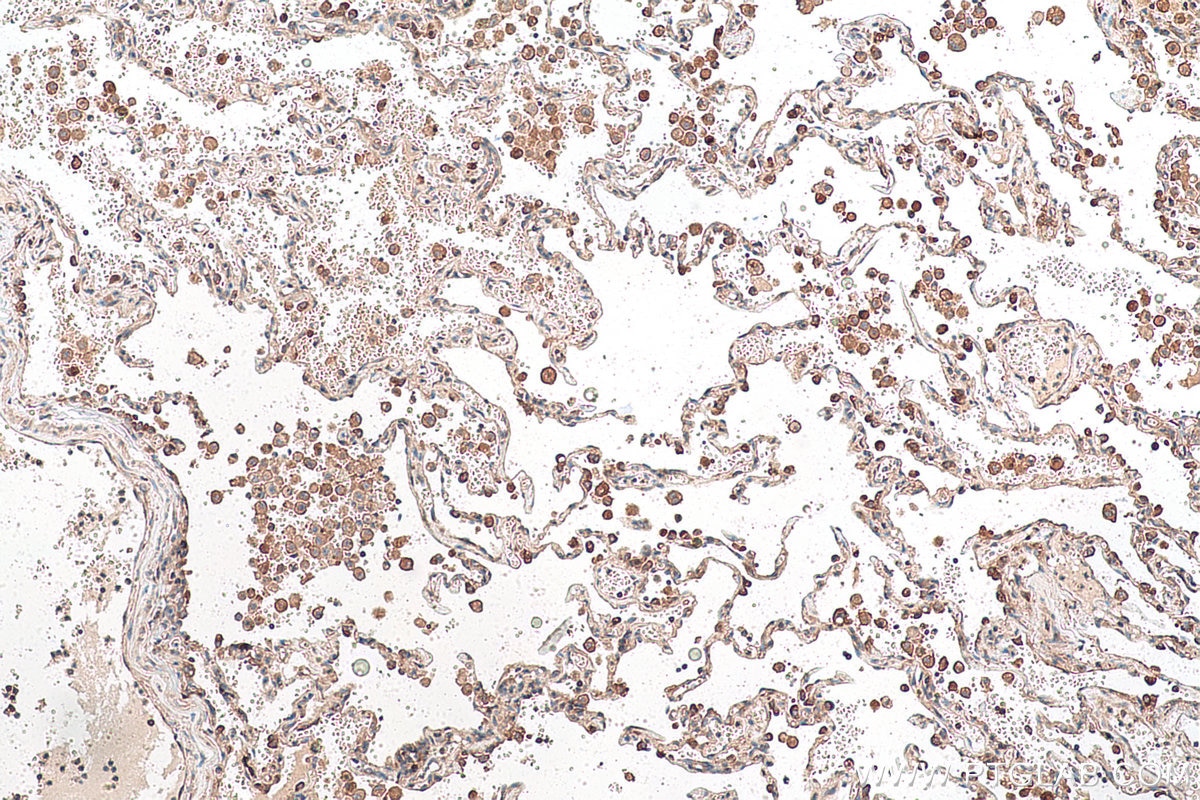 Immunohistochemistry (IHC) staining of human lung tissue using LZTFL1 Polyclonal antibody (17073-1-AP)