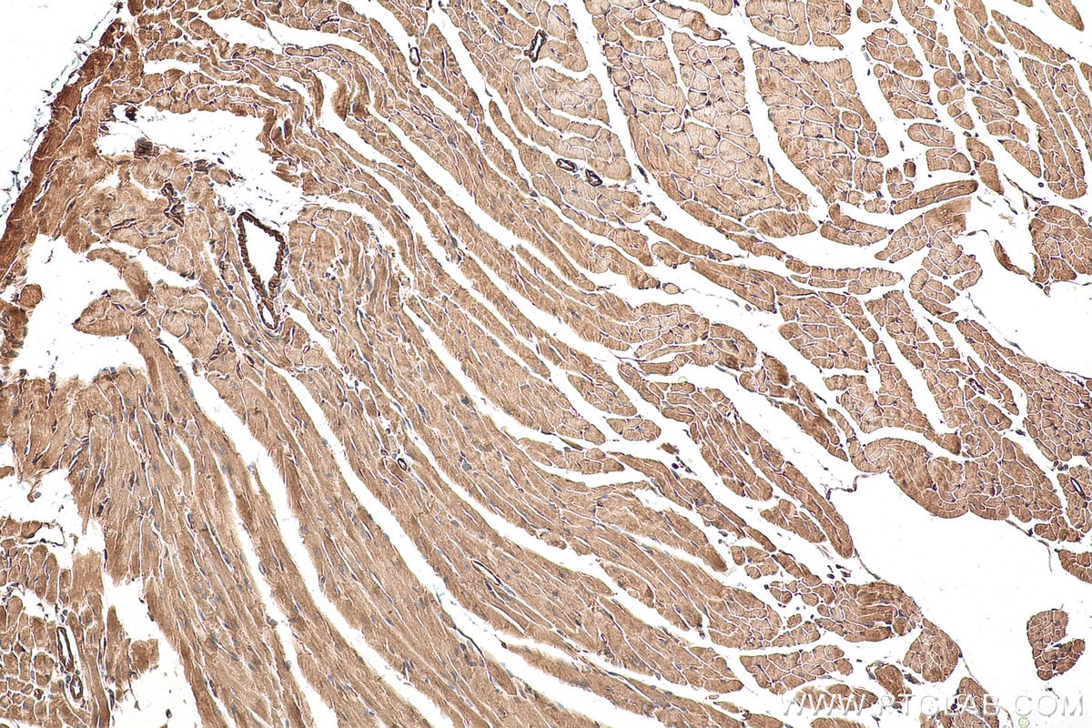 Immunohistochemistry (IHC) staining of mouse heart tissue using LZTFL1 Polyclonal antibody (17073-1-AP)