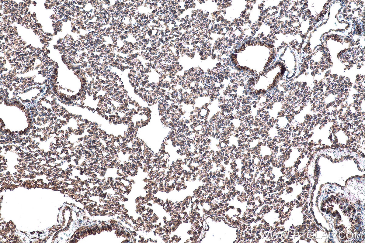 Immunohistochemistry (IHC) staining of mouse lung tissue using LZTFL1 Polyclonal antibody (17073-1-AP)