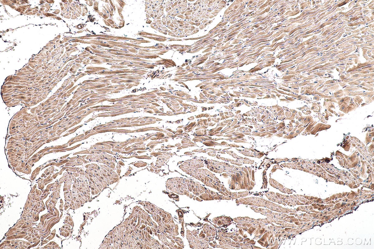 Immunohistochemistry (IHC) staining of rat heart tissue using LZTFL1 Polyclonal antibody (17073-1-AP)