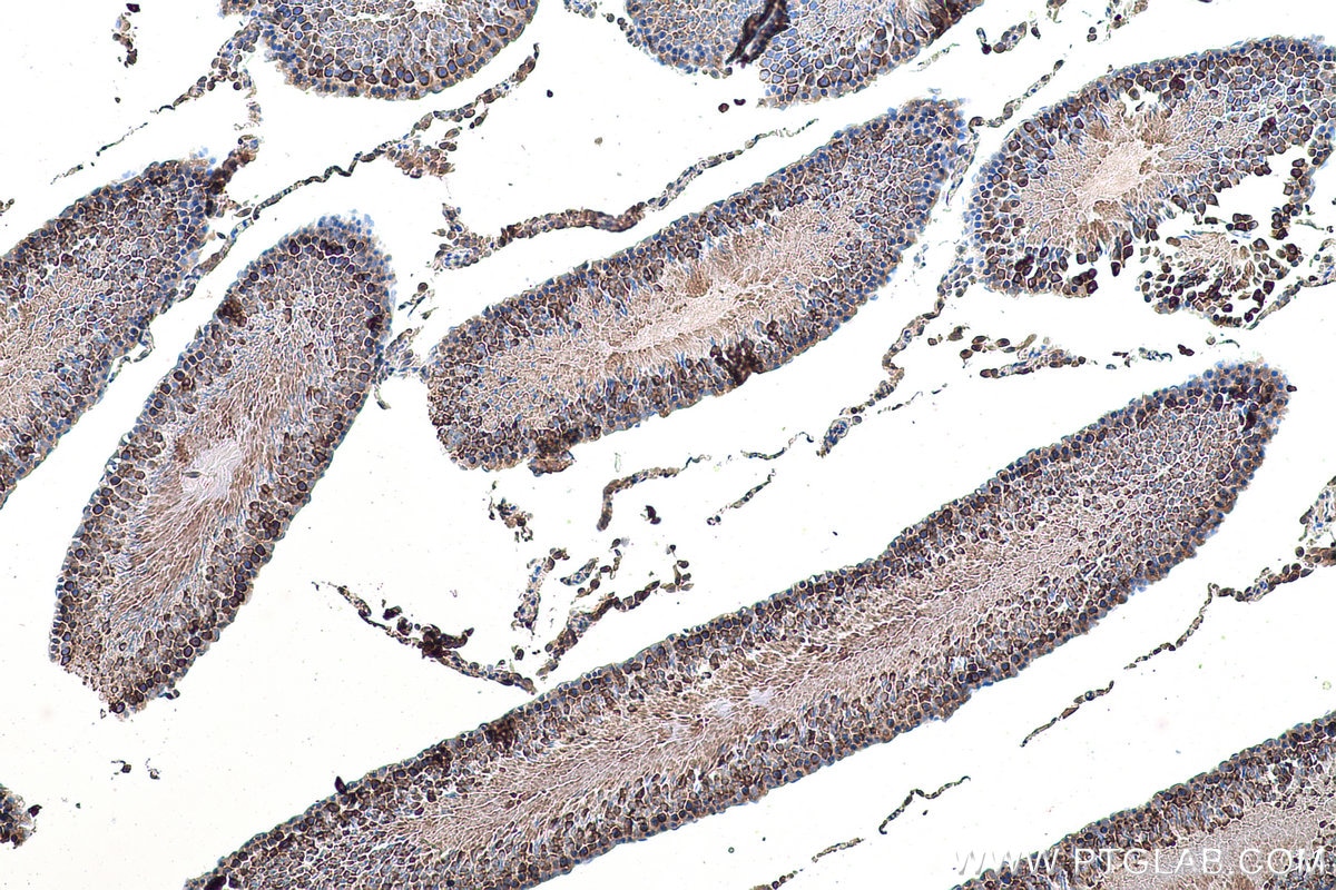 IHC staining of rat testis using 17073-1-AP