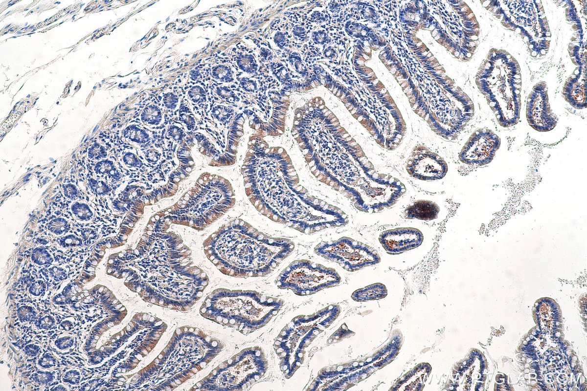 Immunohistochemistry (IHC) staining of human small intestine tissue using LZTFL1 Polyclonal antibody (17073-1-AP)