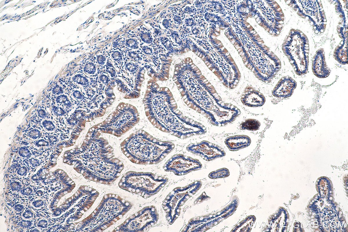 IHC staining of human small intestine using 17073-1-AP