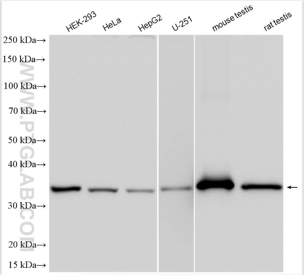 Western Blot (WB) analysis of various lysates using LZTFL1 Polyclonal antibody (17073-1-AP)