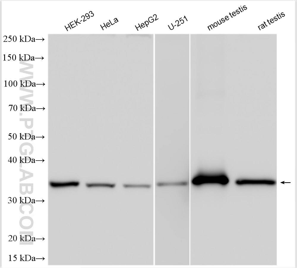 Western Blot (WB) analysis of various lysates using LZTFL1 Polyclonal antibody (17073-1-AP)