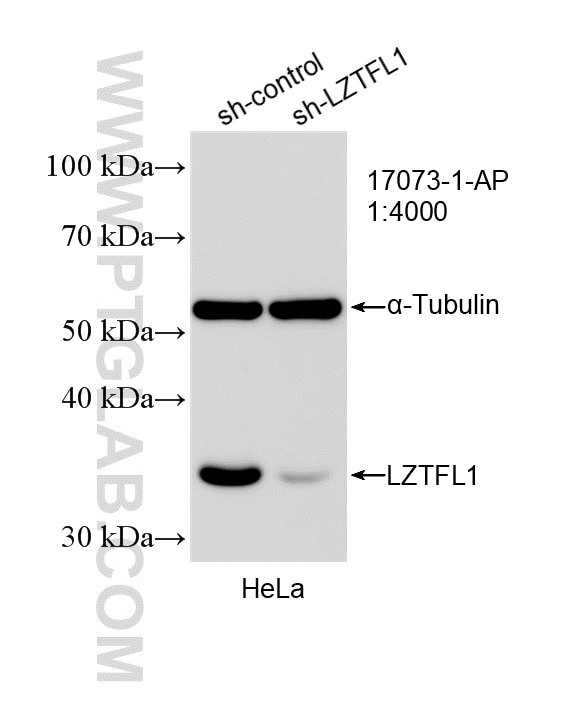 WB analysis of HeLa using 17073-1-AP Western Blot (WB) analysis of HeLa cells using LZTFL1 Polyclonal antibody (17073-1-AP)