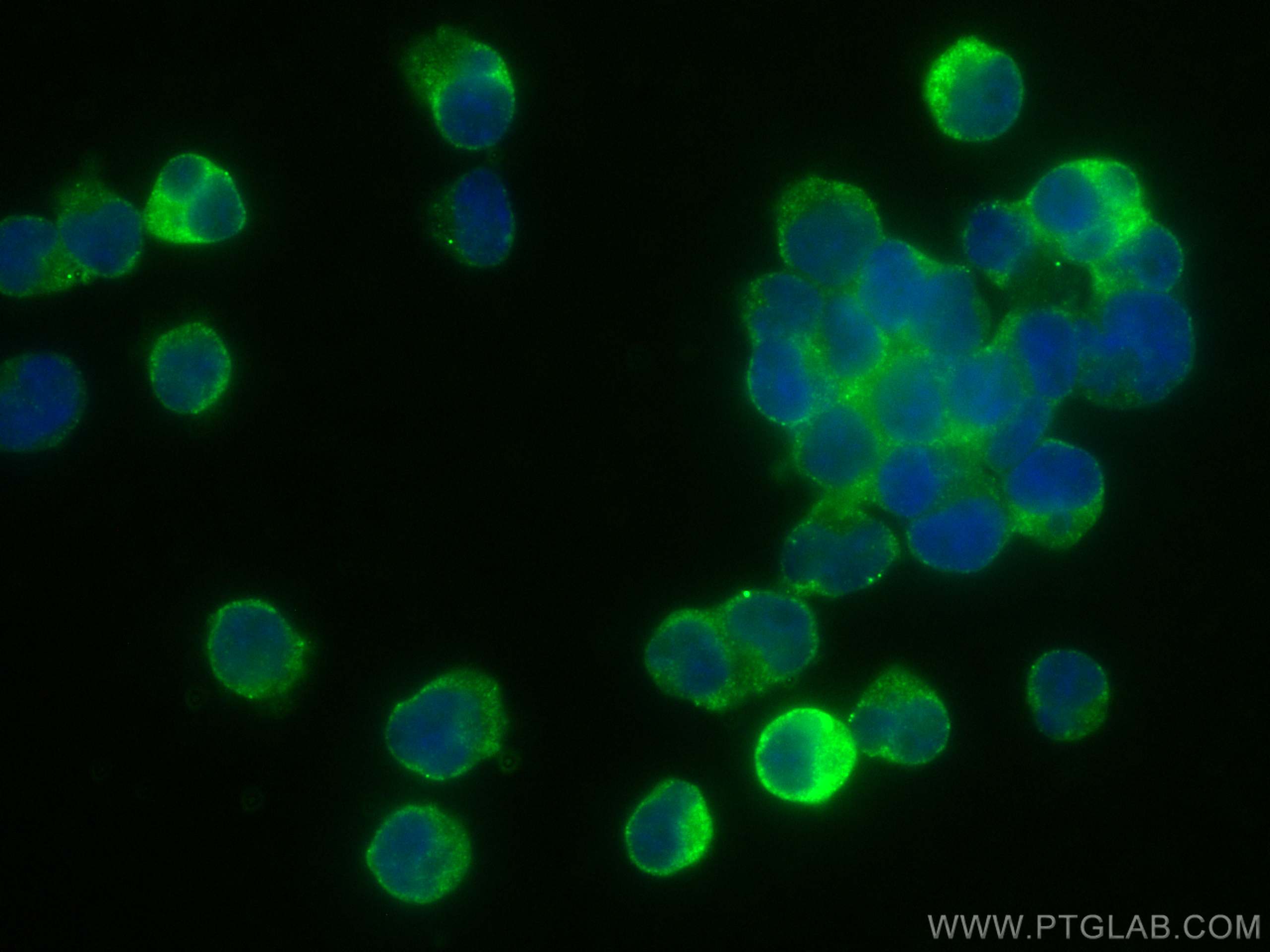 Immunofluorescence (IF) / fluorescent staining of Jurkat cells using LZTFL1 Monoclonal antibody (68281-1-Ig)