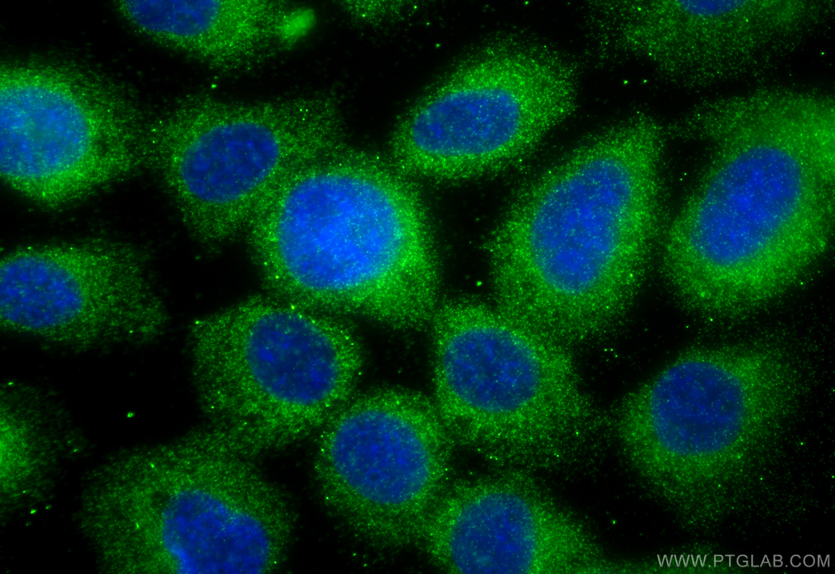 Immunofluorescence (IF) / fluorescent staining of A431 cells using LZTFL1 Monoclonal antibody (68281-1-Ig)