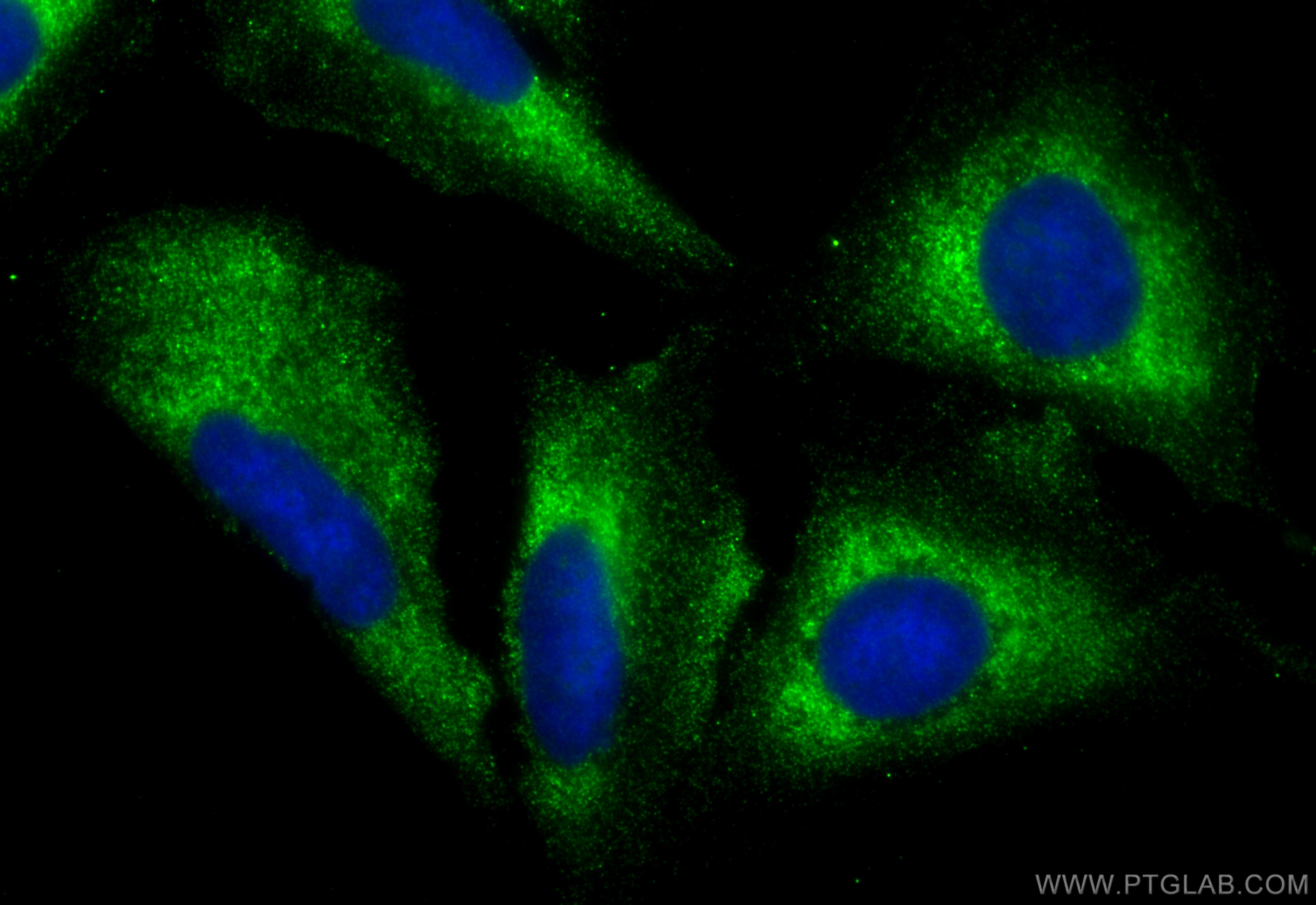 Immunofluorescence (IF) / fluorescent staining of U2OS cells using CoraLite® Plus 488-conjugated LZTFL1 Monoclonal an (CL488-68281)
