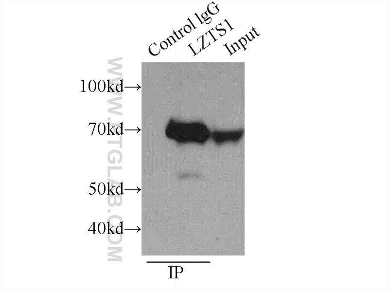Immunoprecipitation (IP) experiment of mouse brain tissue using LZTS1 Polyclonal antibody (20878-1-AP)