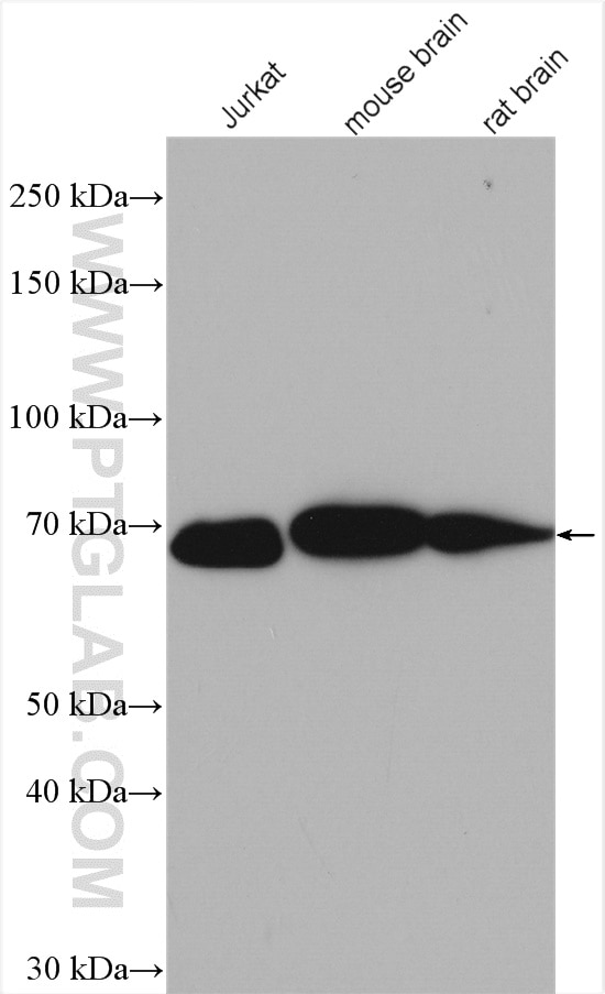 Western Blot (WB) analysis of various lysates using LZTS1 Polyclonal antibody (20878-1-AP)