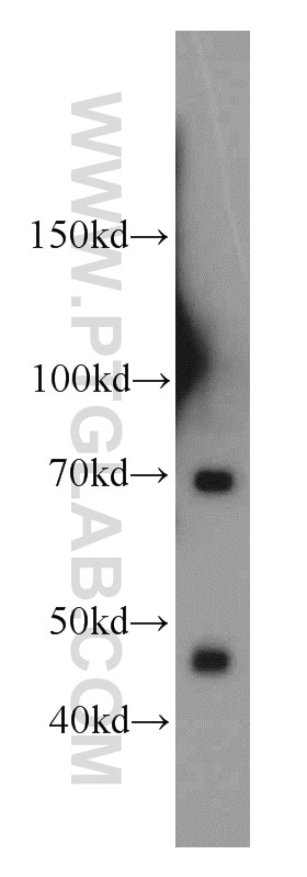 Western Blot (WB) analysis of PC-3 cells using LZTS1 Polyclonal antibody (20878-1-AP)