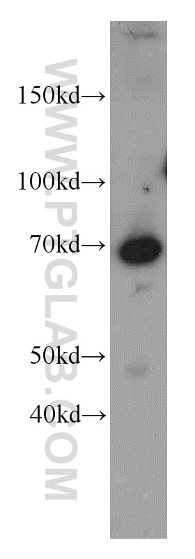 Western Blot (WB) analysis of mouse thymus tissue using LZTS1 Polyclonal antibody (20878-1-AP)