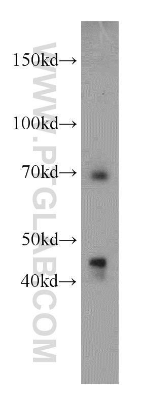 Western Blot (WB) analysis of HEK-293 cells using LZTS1 Polyclonal antibody (20878-1-AP)