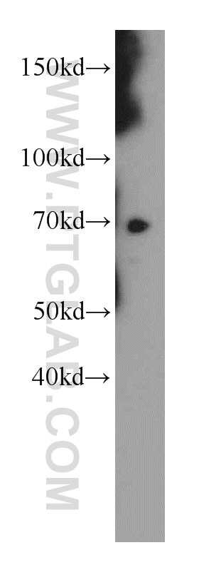 Western Blot (WB) analysis of mouse ovary tissue using LZTS1 Polyclonal antibody (20878-1-AP)