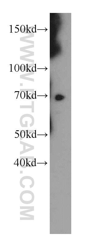 WB analysis of mouse ovary using 20878-1-AP