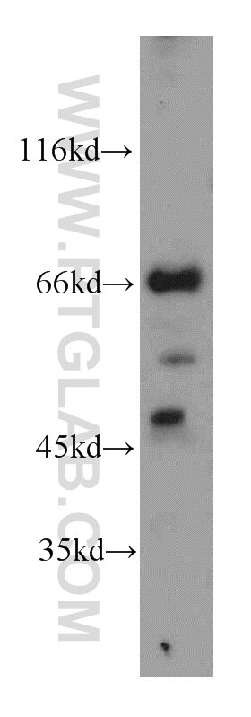 Western Blot (WB) analysis of human testis tissue using LZTS1 Polyclonal antibody (20878-1-AP)