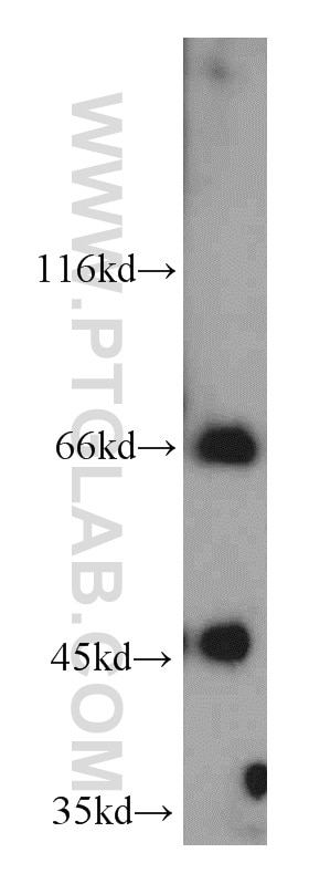 Western Blot (WB) analysis of Jurkat cells using LZTS1 Polyclonal antibody (20878-1-AP)