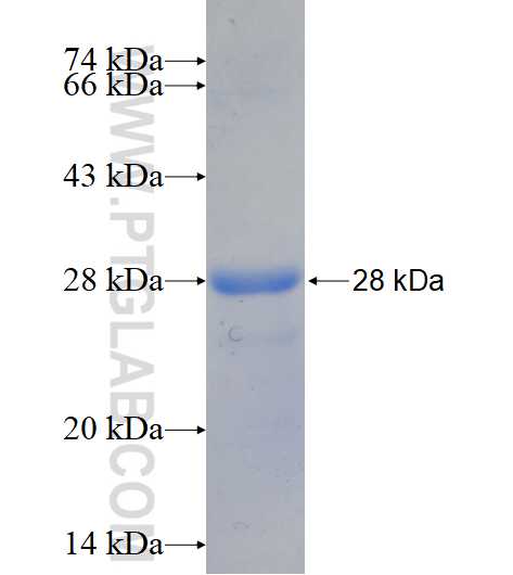 LZTS1 fusion protein Ag15176 SDS-PAGE