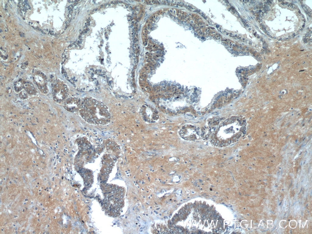 Immunohistochemistry (IHC) staining of human prostate hyperplasia tissue using LZTS2 Polyclonal antibody (15677-1-AP)