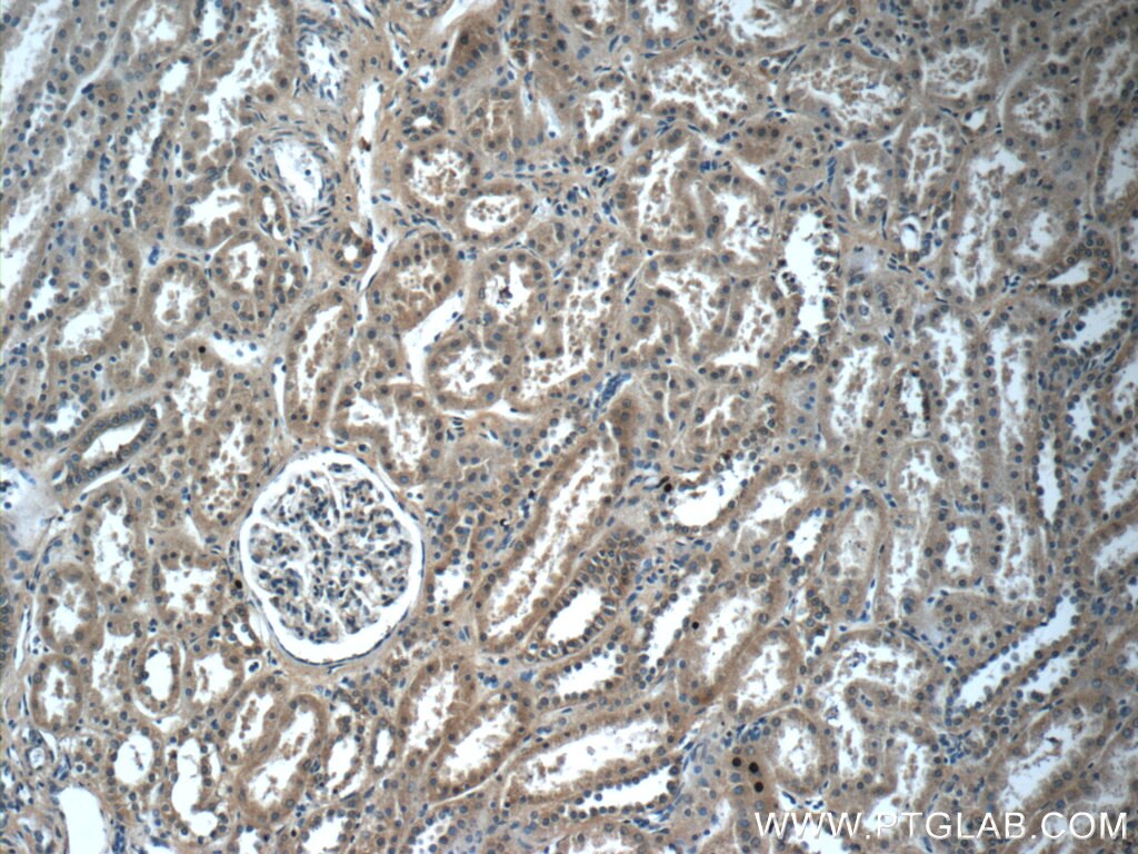 Immunohistochemistry (IHC) staining of human kidney tissue using LZTS2 Polyclonal antibody (15677-1-AP)