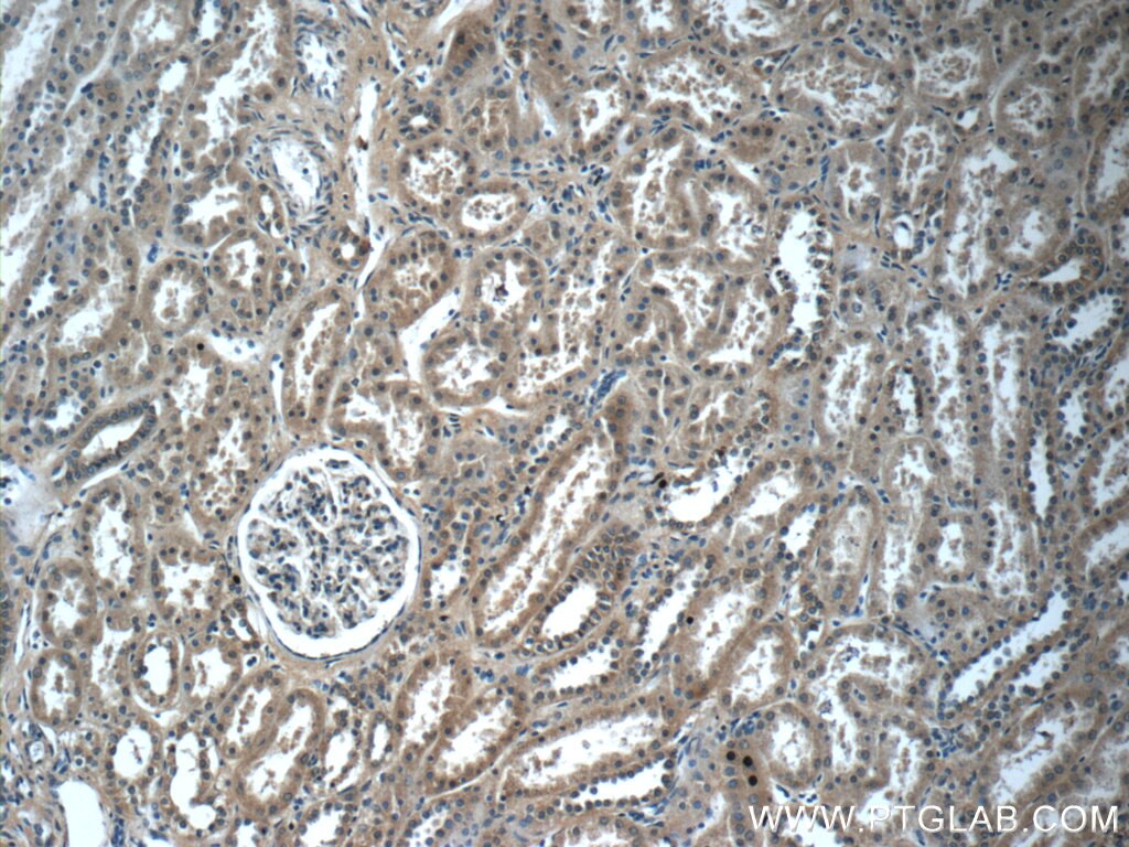 Immunohistochemistry (IHC) staining of human kidney tissue using LZTS2 Polyclonal antibody (15677-1-AP)