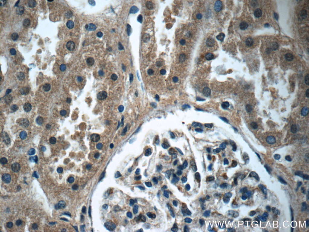 Immunohistochemistry (IHC) staining of human kidney tissue using LZTS2 Polyclonal antibody (15677-1-AP)