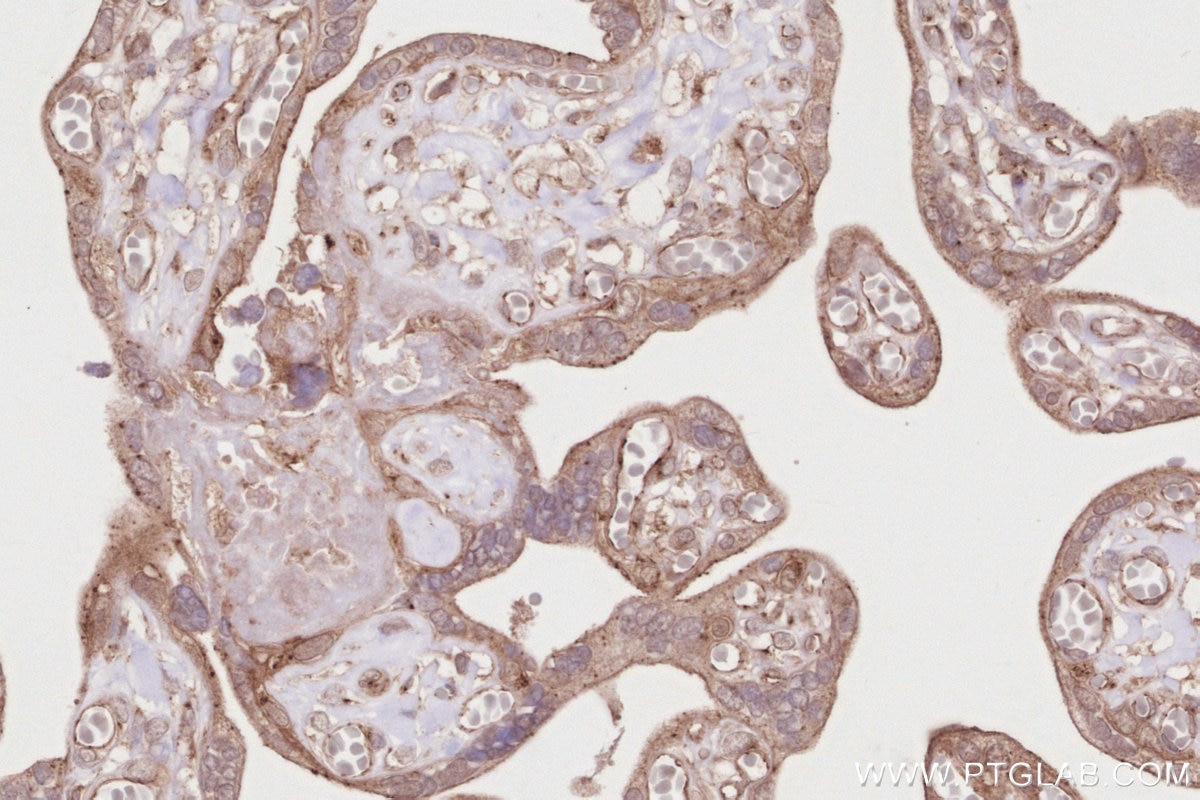 Immunohistochemistry (IHC) staining of human placenta tissue using LZTS2 Polyclonal antibody (15677-1-AP)