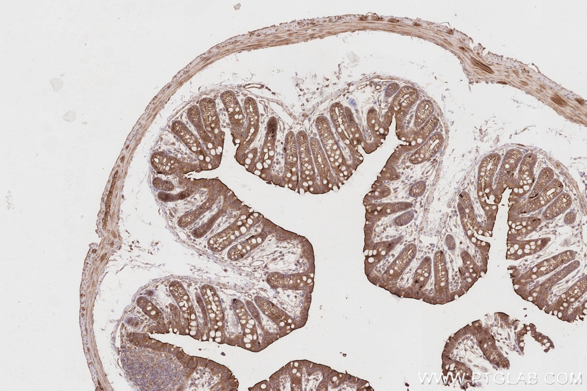 Immunohistochemistry (IHC) staining of mouse colon tissue using LZTS2 Polyclonal antibody (15677-1-AP)