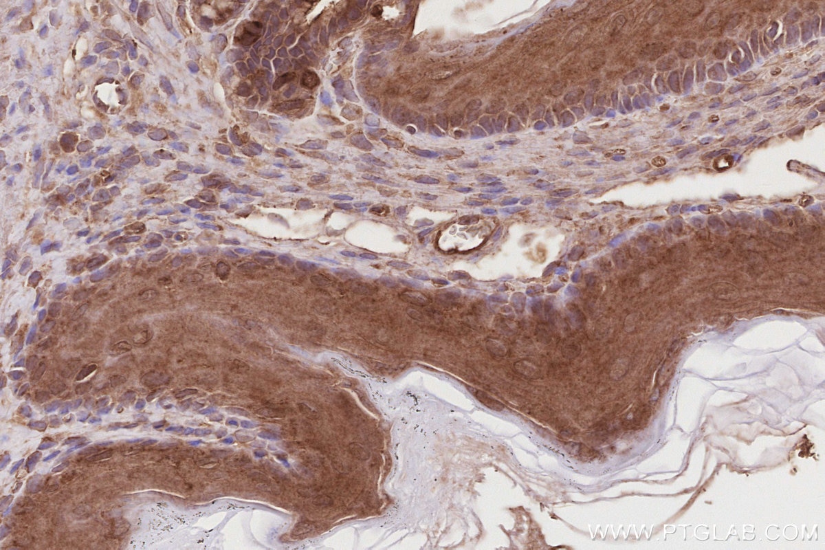 Immunohistochemistry (IHC) staining of mouse stomach tissue using LZTS2 Polyclonal antibody (15677-1-AP)