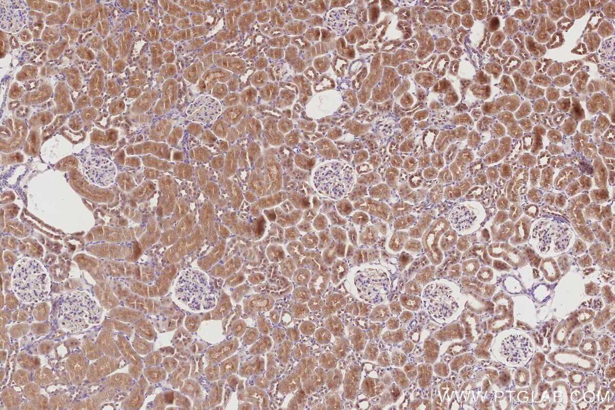 Immunohistochemistry (IHC) staining of rat kidney tissue using LZTS2 Polyclonal antibody (15677-1-AP)