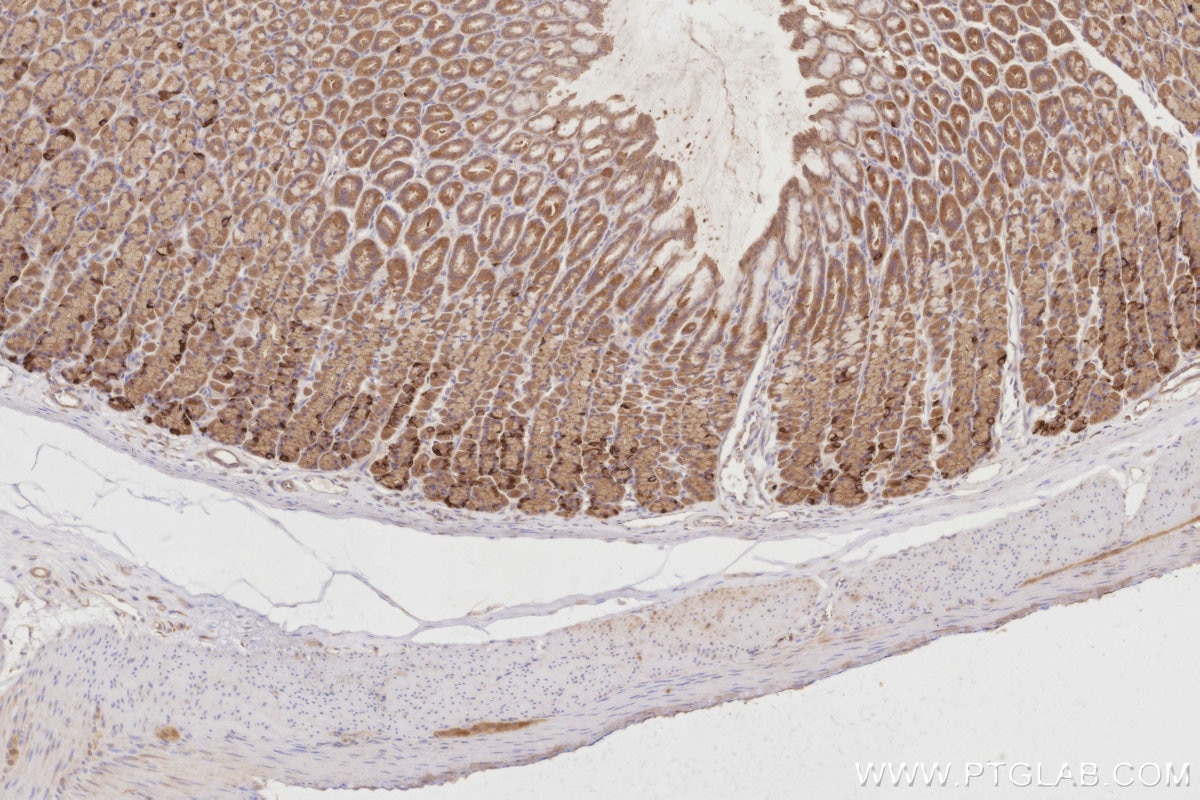 Immunohistochemistry (IHC) staining of rat stomach tissue using LZTS2 Polyclonal antibody (15677-1-AP)