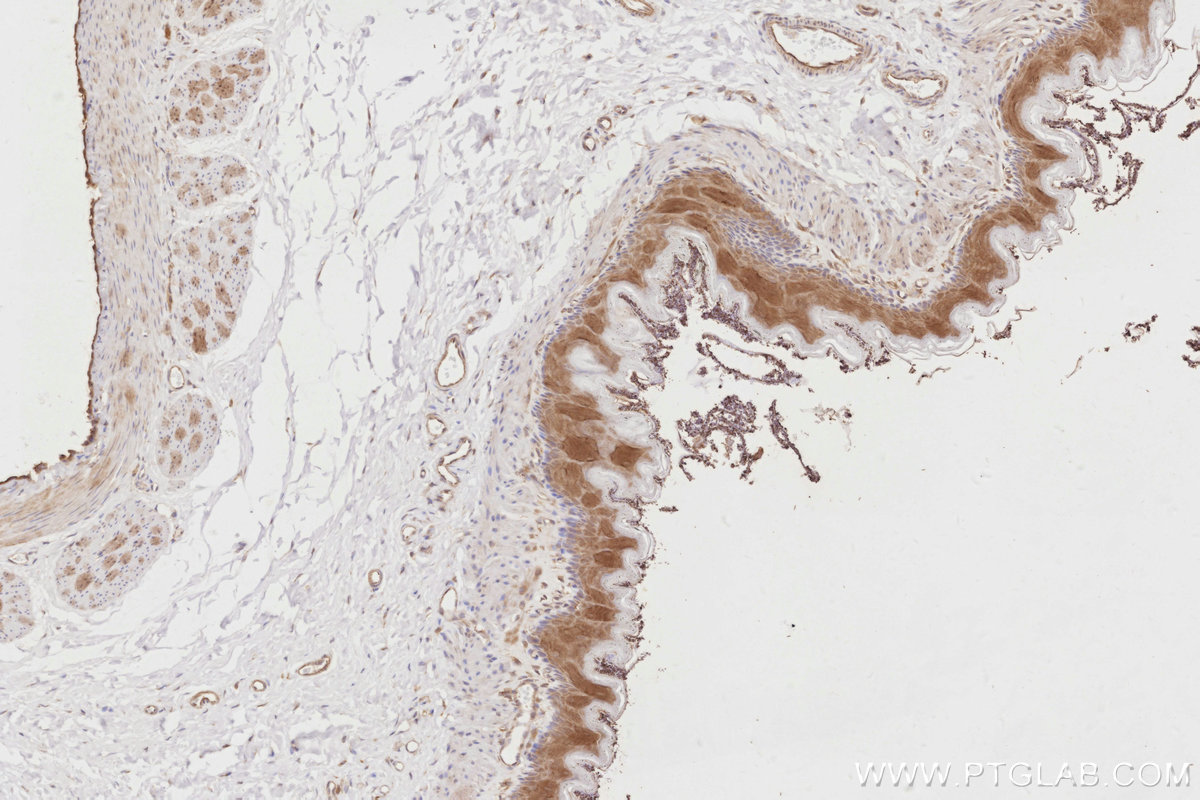 Immunohistochemistry (IHC) staining of rat stomach tissue using LZTS2 Polyclonal antibody (15677-1-AP)