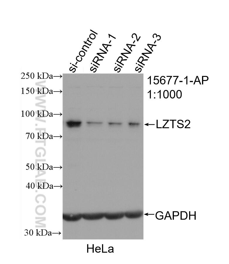 Western Blot (WB) analysis of HeLa cells using LZTS2 Polyclonal antibody (15677-1-AP)